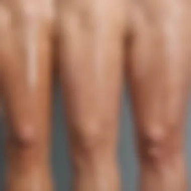 Illustration of different types of skin discoloration on the leg