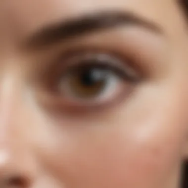 Understanding Eye Area Discoloration A close-up of the eye area with visible discoloration